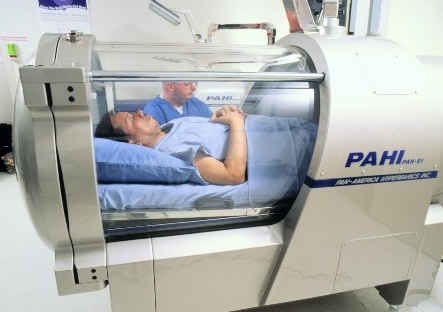 Hyperbaric Oxygen Therapy Chamber